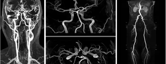 Ricostruzioni 3D per esami TAC